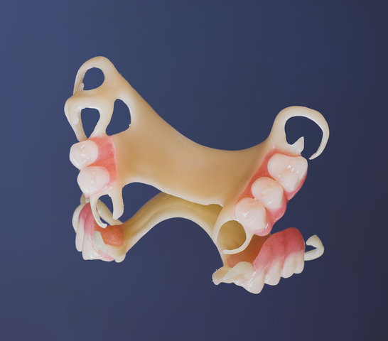 acetal denture